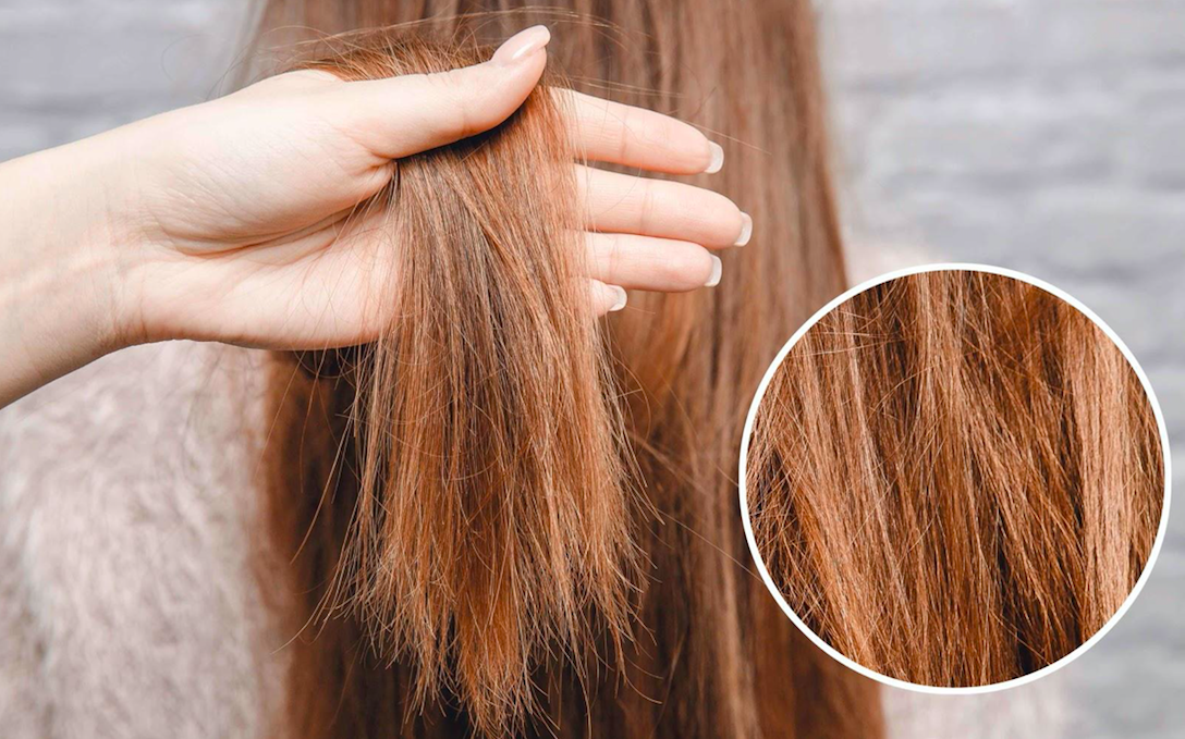 rụng tóc nhiều mùa thu đông