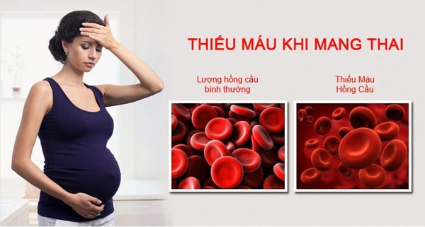 thiếu máu khi mang thai