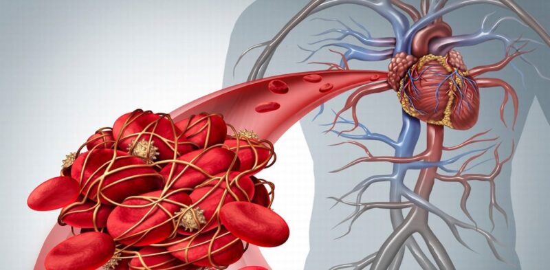 Tác dụng tiêu sợi huyết của Nattokinase: Bảo vệ mạch máu người già giữa mùa "bão lửa"