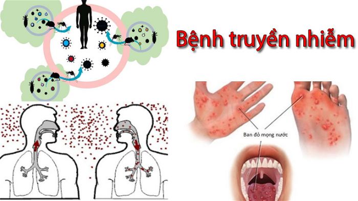 phòng chống bệnh truyền nhiễm