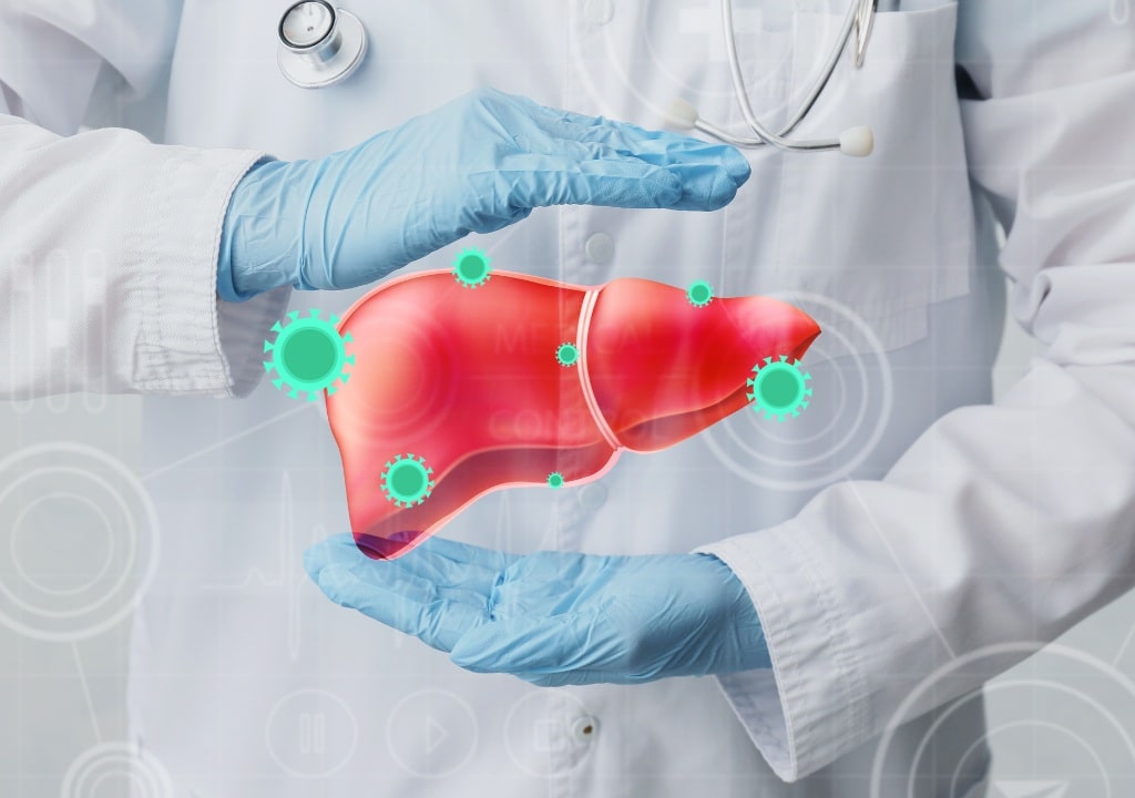 Người bị gan nhiễm mỡ độ 1, độ 2: Kanzo Ukon hỗ trợ phục hồi chức năng gan như thế nào?