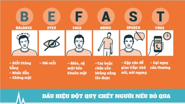 10 dấu hiệu cảnh báo đột quỵ sớm bạn không nên bỏ qua